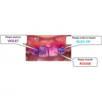 Tri Plaque ID Gel - GC