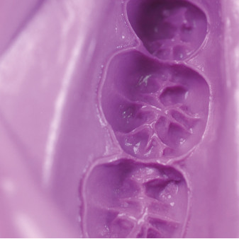Alginate Hydrogum 5 - Zhermack